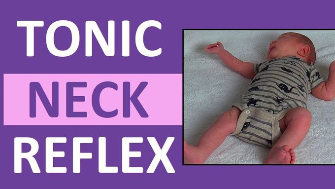 Tonic Neck Reflex in Infant Newborn