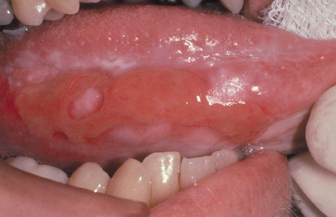 Allergic Mucosal Reaction to Systemic Drug Administration.
