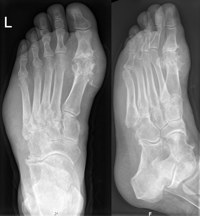 Diagnosis?