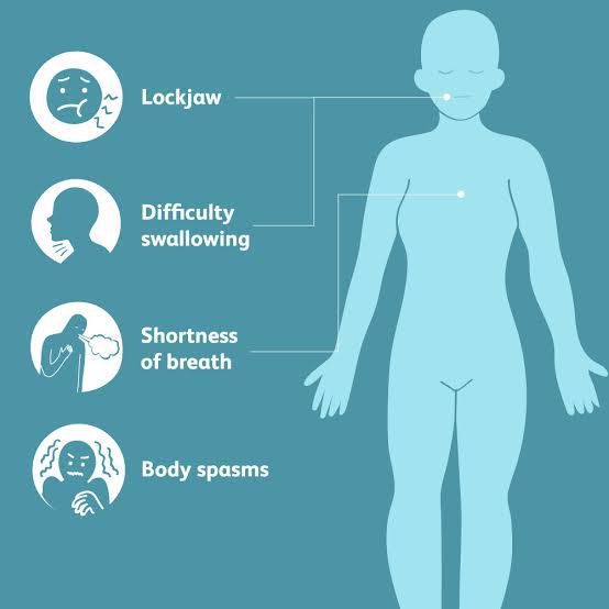 Tetanus symptoms - MEDizzy