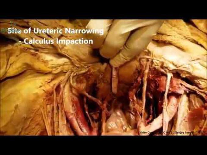 Surgical Anatomy of Bladder