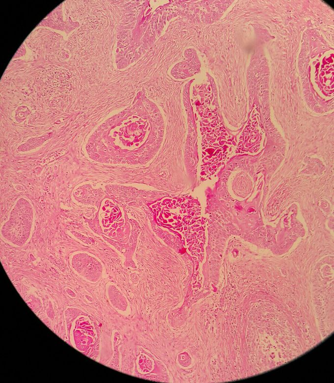 What's your diagnosis??