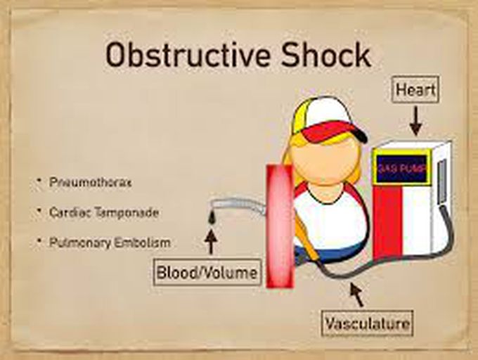 Symptoms of obstructive shock