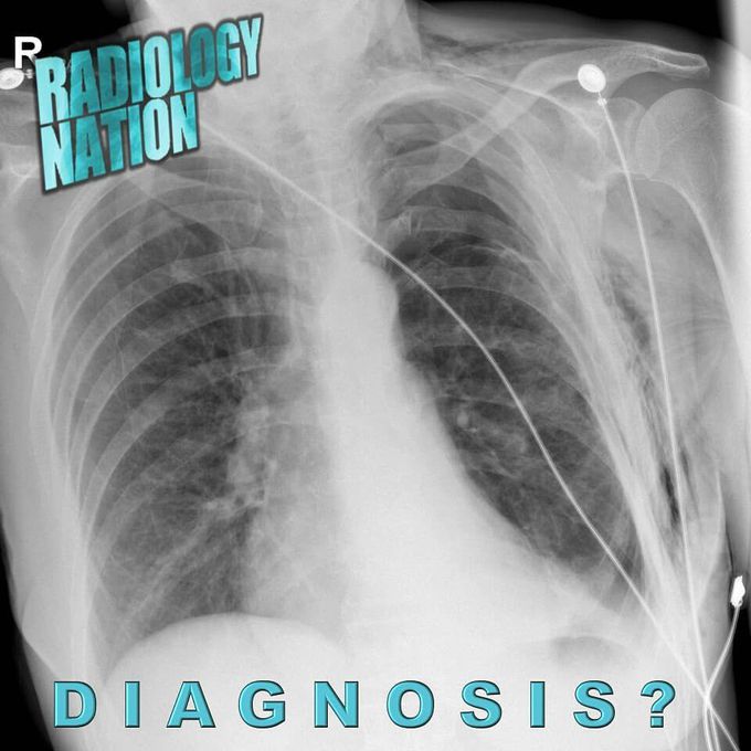 What's your diagnosis?