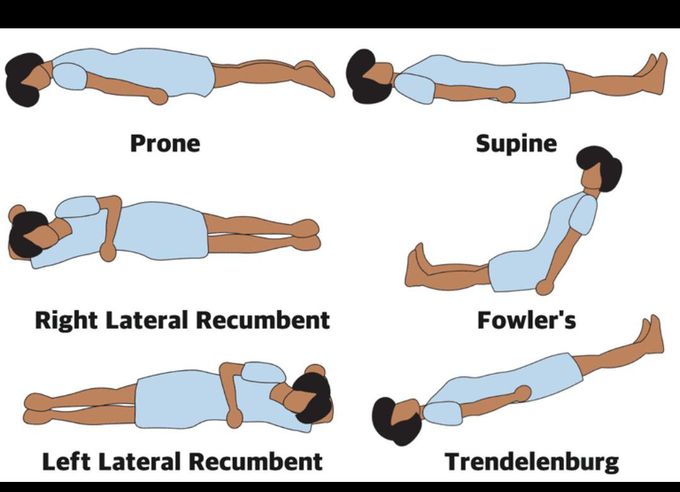 Different positions during Rx of patient