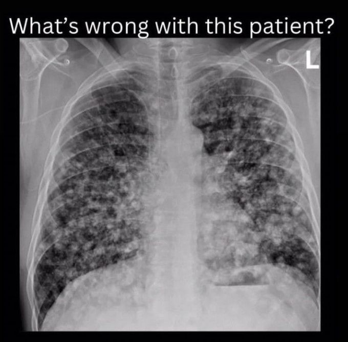 Identify the Pathology