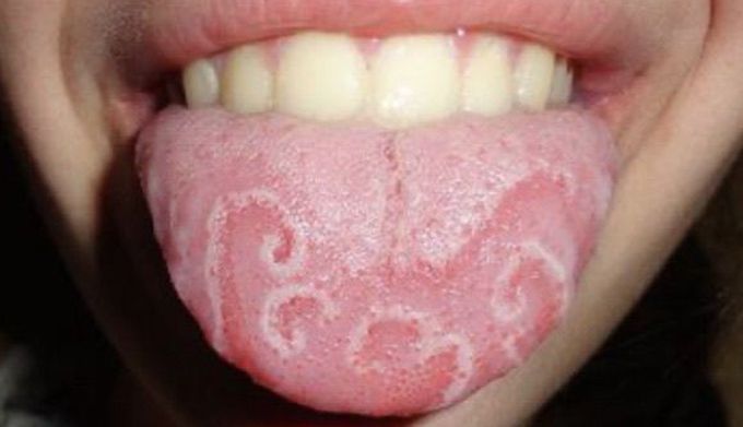 Geography tongue