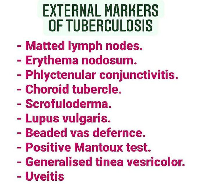External markers of tuberculosis!