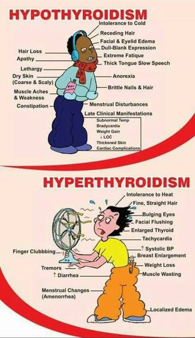 Hypothyroidism Vs hyperthyroidism