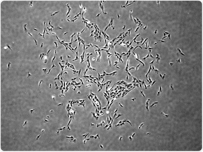 Scientists discover and characterize human skeletal stem cells
