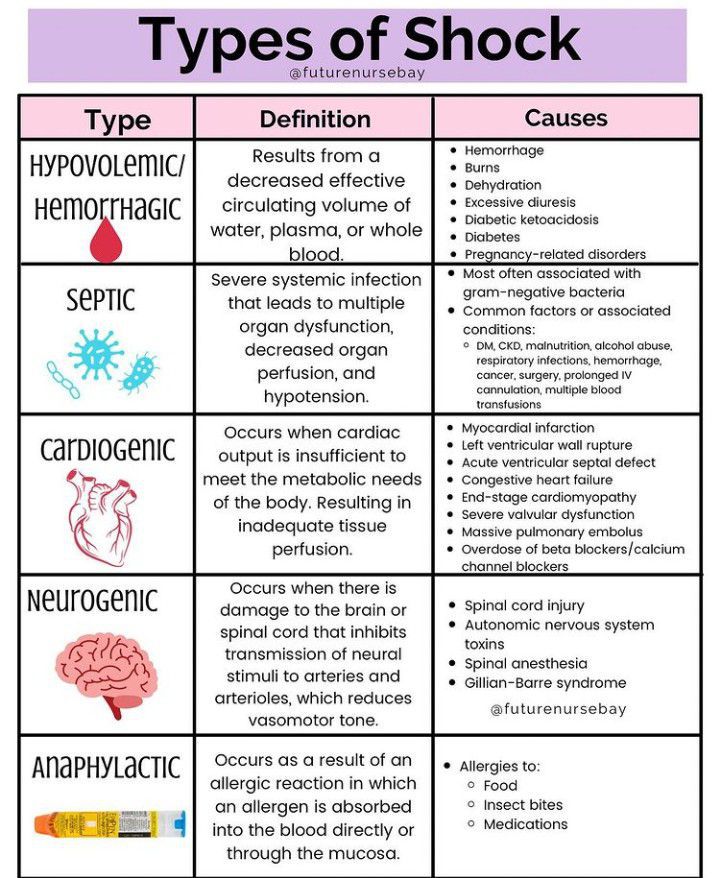 Types Of Shock Comparison Chart