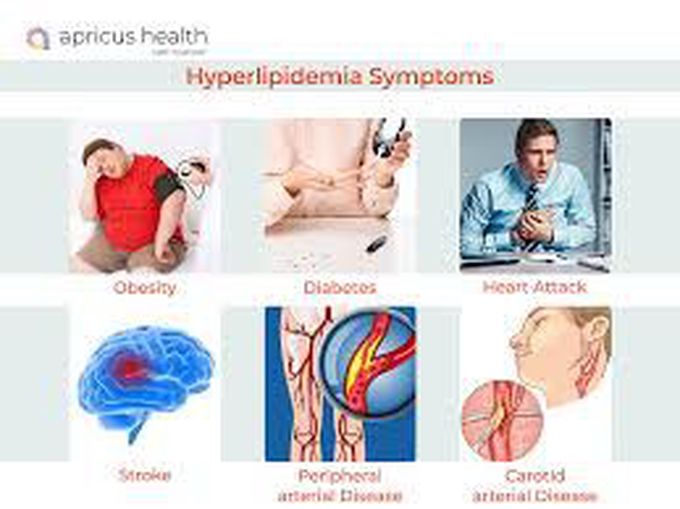 Symptoms of hyperlipidemia medizzy