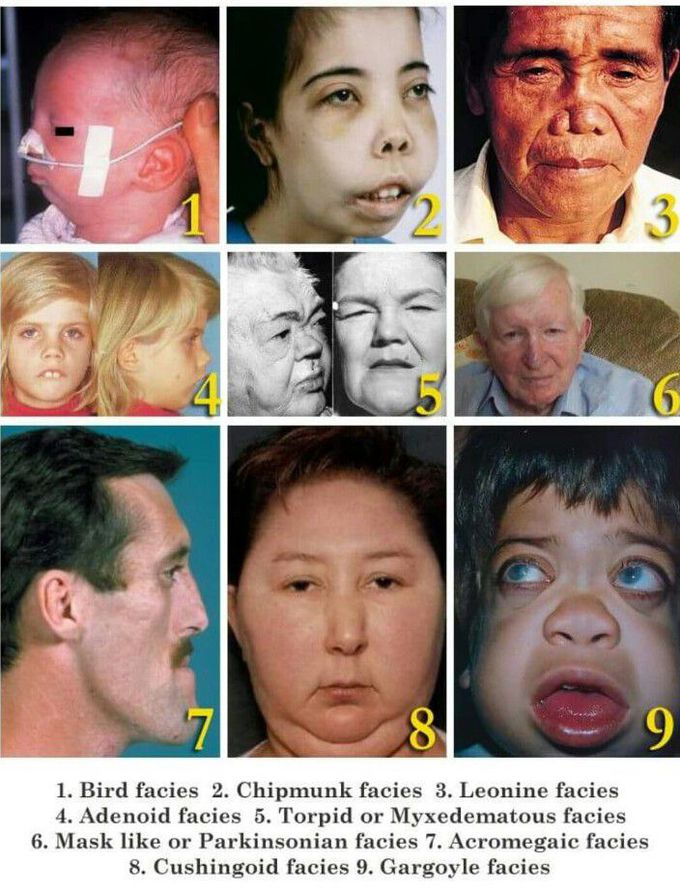 Different types of face