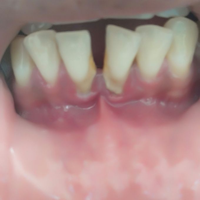Dental health