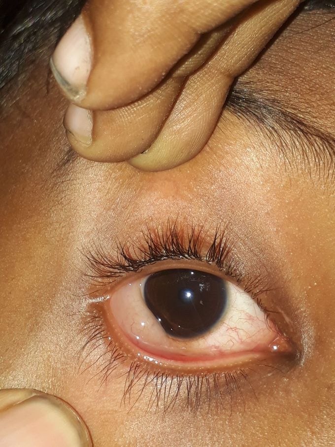 Diagnosis and medication