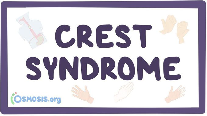 CREST syndrome - causes, symptoms, diagnosis, treatment, pathology