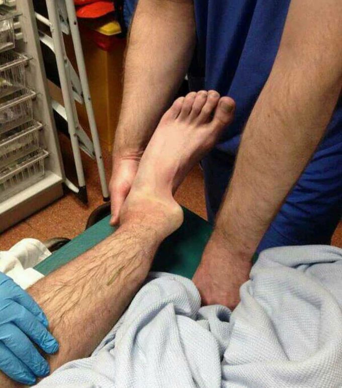 Dislocated leg discount