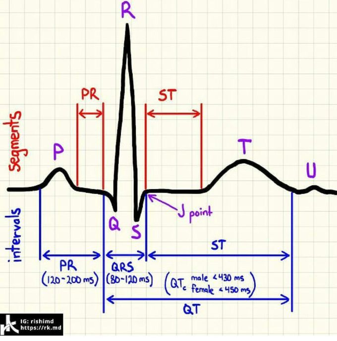 Ecg basic - MEDizzy