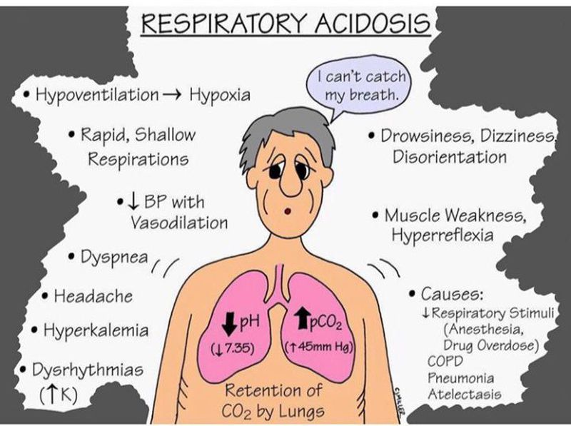 Respiratory acidosis inf... - MEDizzy