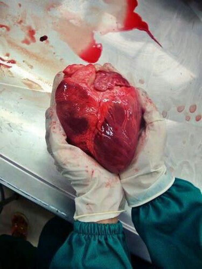 HEART- MOTOR LIFE❤