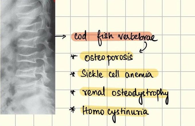 COD FISH VERTEBRAE