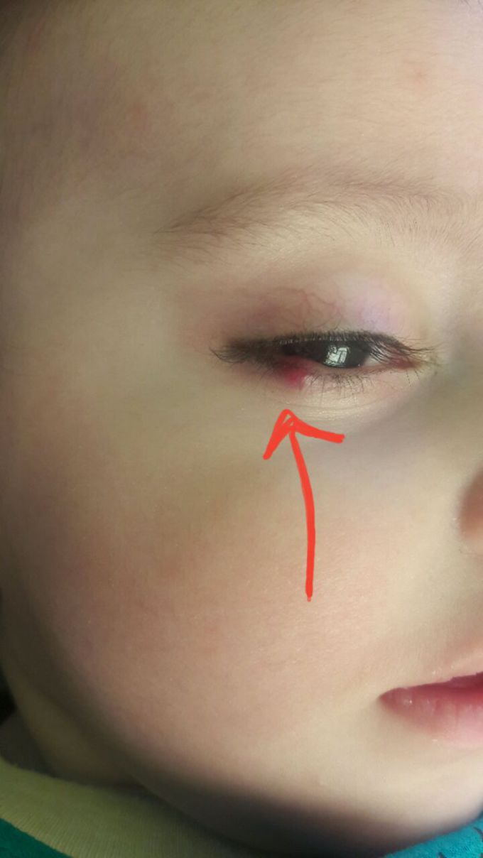 Diagnosis?