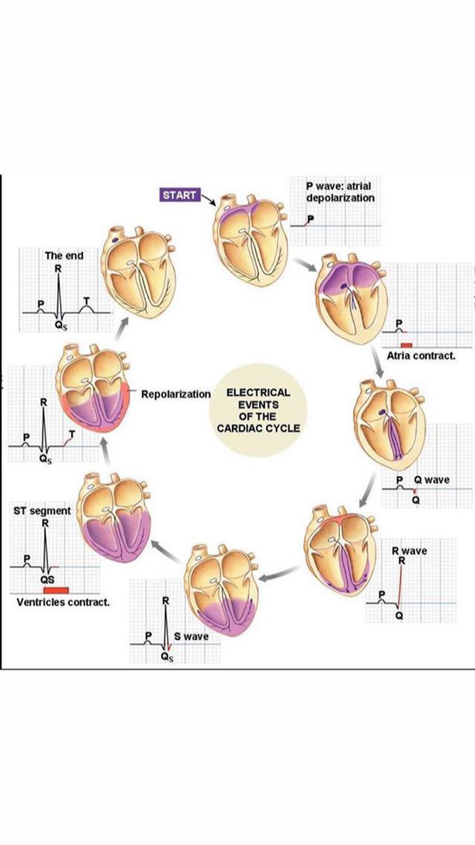 ECG....