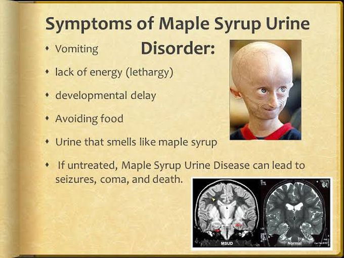 Maple syrup urine disease symptoms MEDizzy