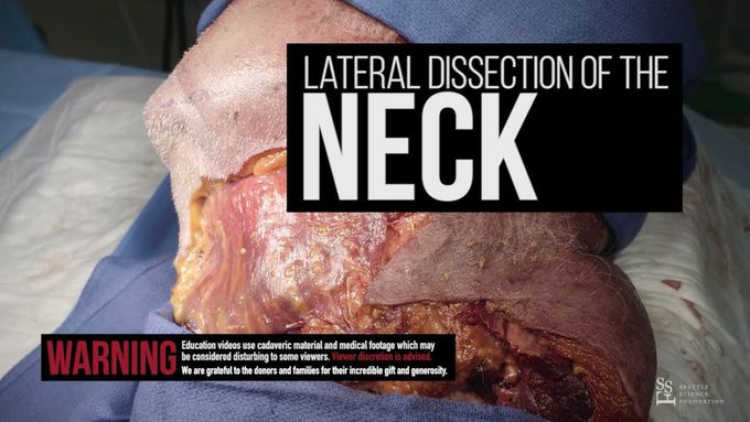 Lateral dissection of the neck - Joe Iwanaga, DDS, PhD