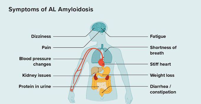 Amyloidosis