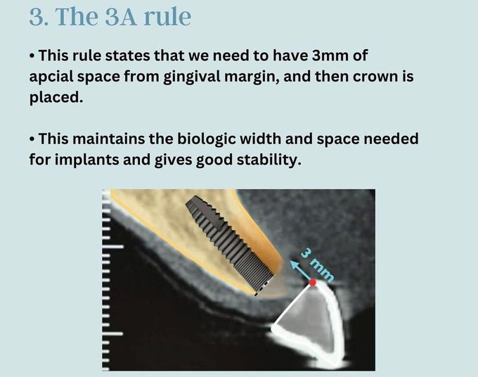 How to Choose the Correct Implant III