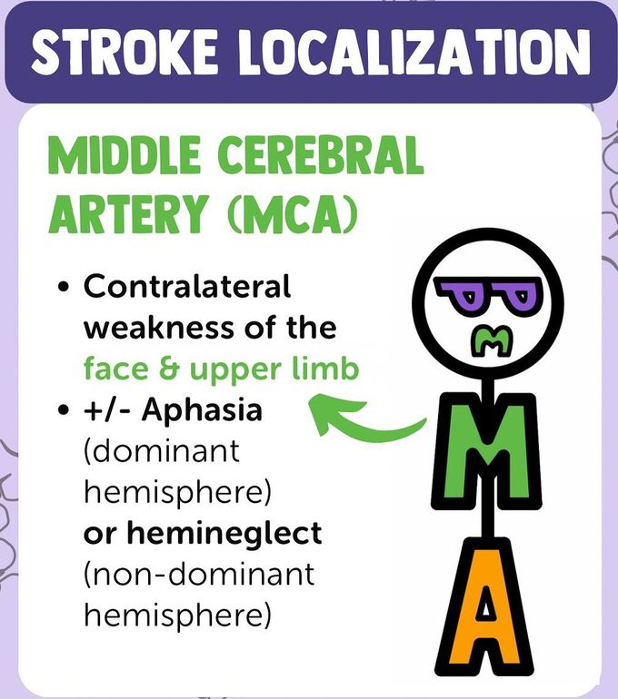 Stroke Localisation II