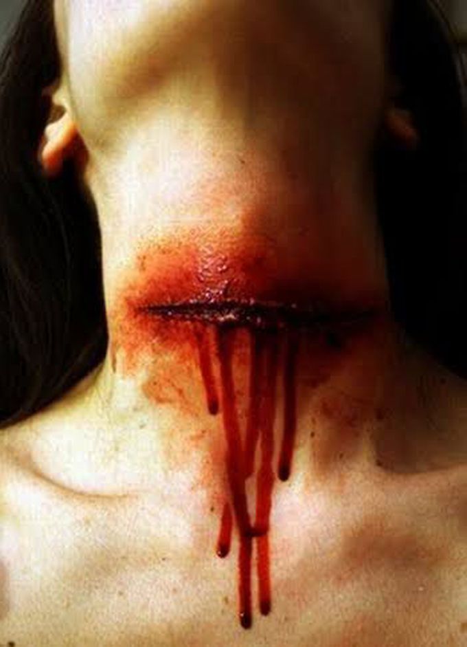 Cut Throat Injury- Suicidal or Homicidal?