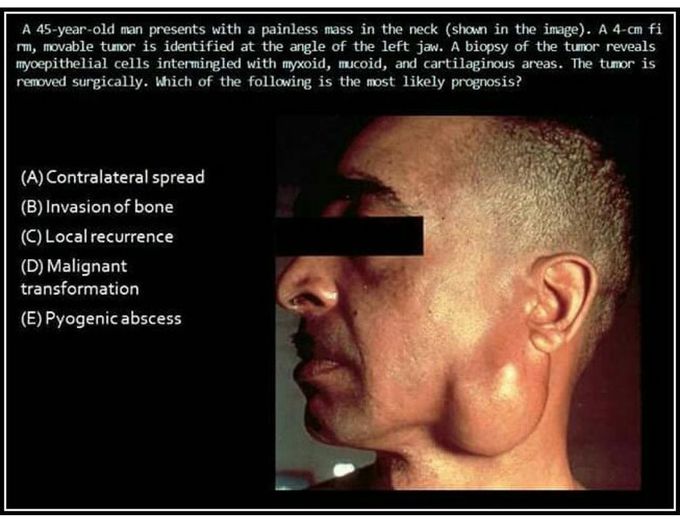 Answer will be published in next 8 hours. Official medicaladdicts page, follow us for more