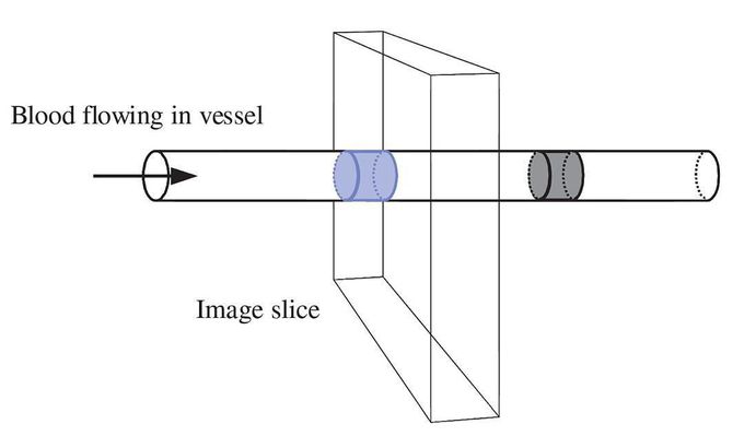 The time-of-flight or in-flow effect
