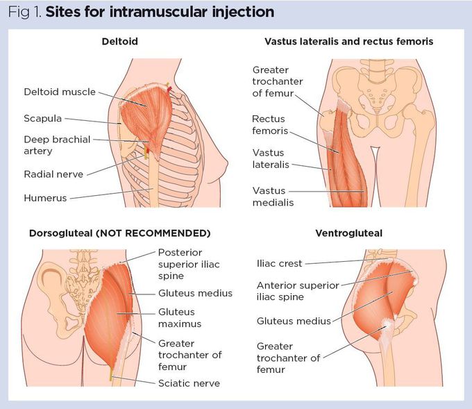 Site of IM injection