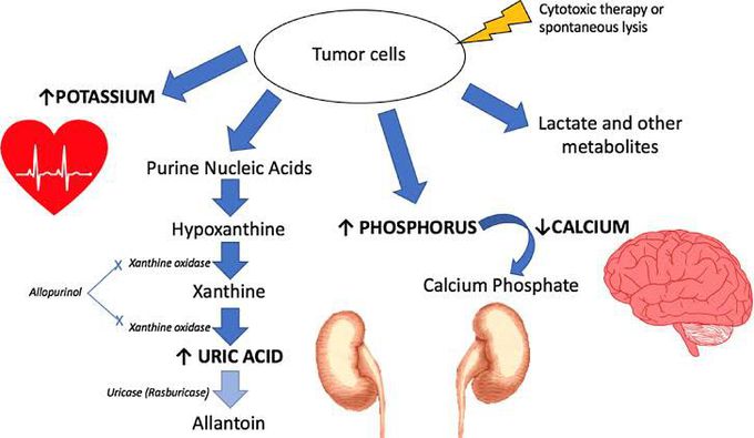 Tumour Lysis Syndrome