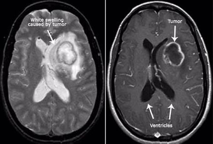 Disease & diagnosis ??????