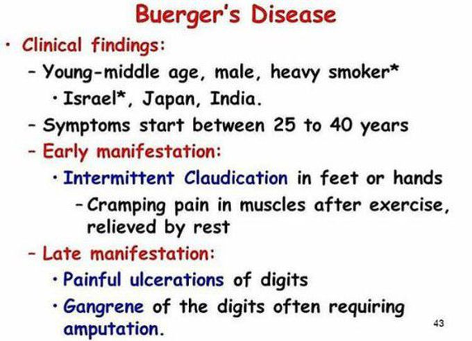 Buerger's disease