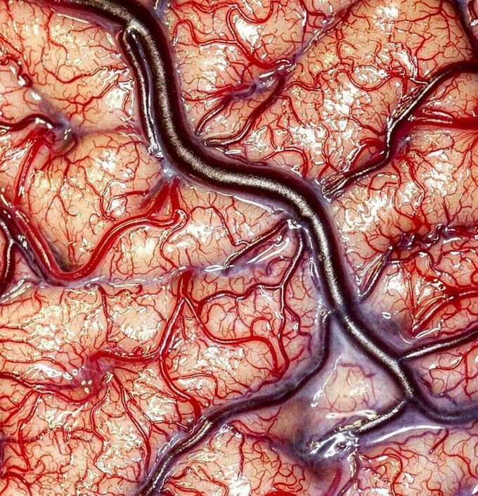 Blood Vessels