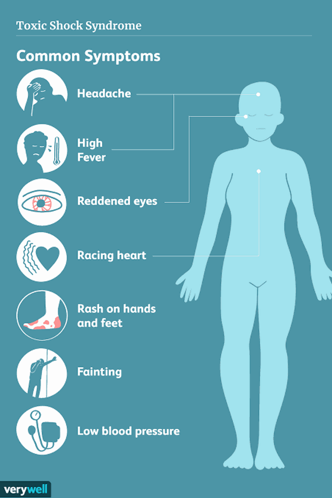 Symptoms of tss