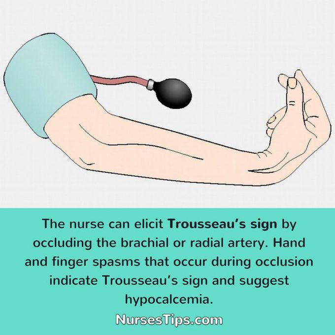 trousseau's sign