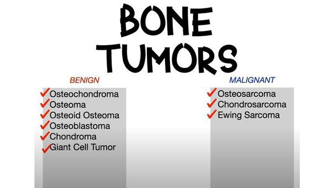 List of some benign and malignant bone tumors