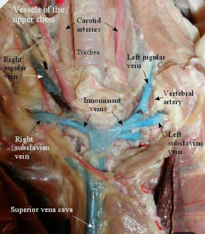 Vessels of upper chest