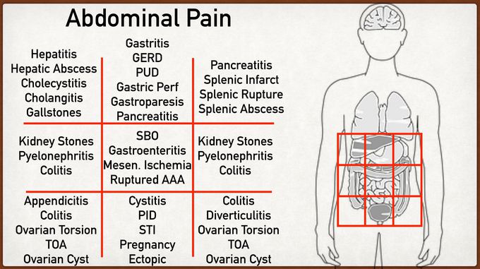 Common Causes of Abdominal Pain According to Location