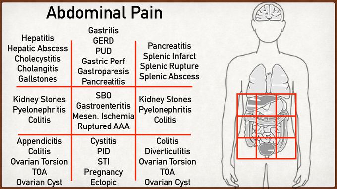 common-causes-of-abdominal-pain-according-to-location-medizzy