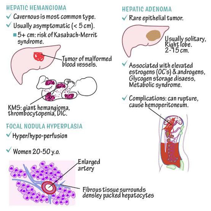 Liver Tumors