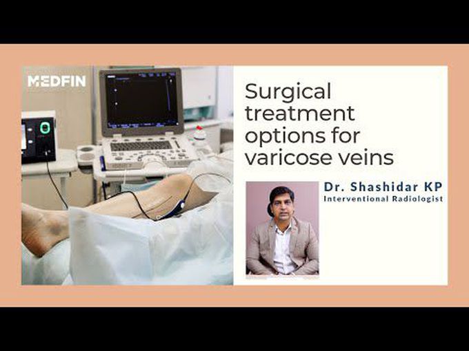 Surgical Treatment for Varicose Veins