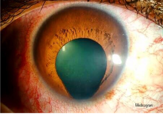 Diagnose the above condition