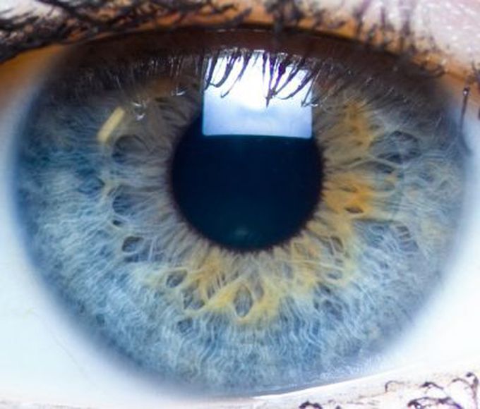 ¿Por qué antibiótico contra la conjuntivitis puede ser la cosa equivocada a hacer?